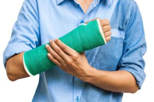 Fracture Management